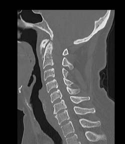 Radiology Seminars MSK Community 