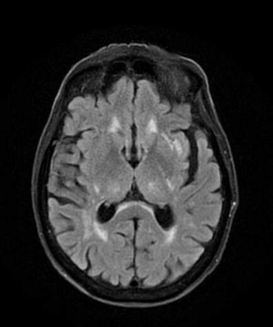 Radiology Seminars Neuro Fellowship