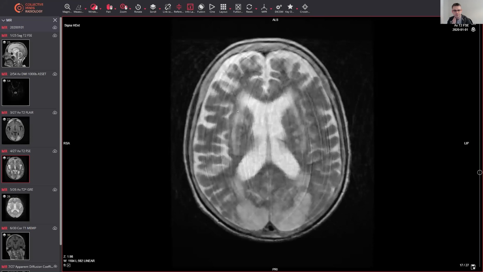 brain x ray